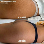 Charger l'image dans la galerie, Contre vergéture
