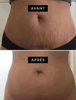 Charger l'image dans la galerie, Contre vergéture
