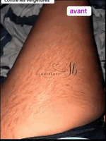 Charger l'image dans la galerie, Contre vergéture
