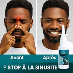 Charger l'image dans la galerie, Nasal Spray
